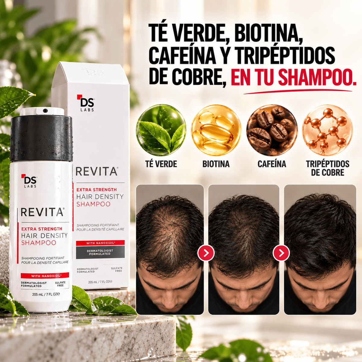 REVITA: Champú para la Densidad del Cabello